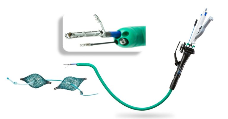 The USGI™ Technology for Endo Luminal Bariatric Procedures - Medispar